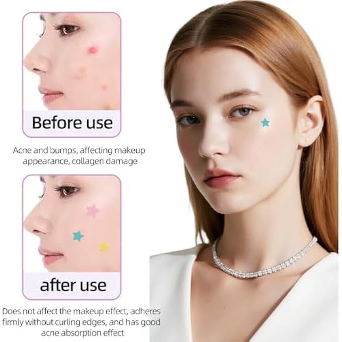 STRBOXONG SKIN CONTROL PIMPLE PATCHES FOR FACE, PIMPLE PATCH STAR SPOT STICKERS COVERS,ACNE PATCH STAR FACE,HYDROCOLLOID ACNE PATCHES WITH TEA TREE OIL FOR DAY & NIGHT USE(255 COUNT) - Image 3